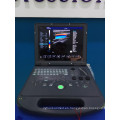 Precio y ecografía Doppler color portátil DW-C60